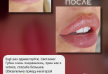 Продающие шаблоны для сторис увеличение продаж в Instagram Инфографика 15 - kwork.ru